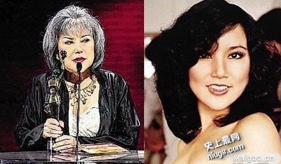 整容失败率有多高 世界10大最可怕的整形失败案
