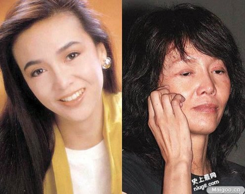 整容失败率有多高 世界10大最可怕的整形失败案